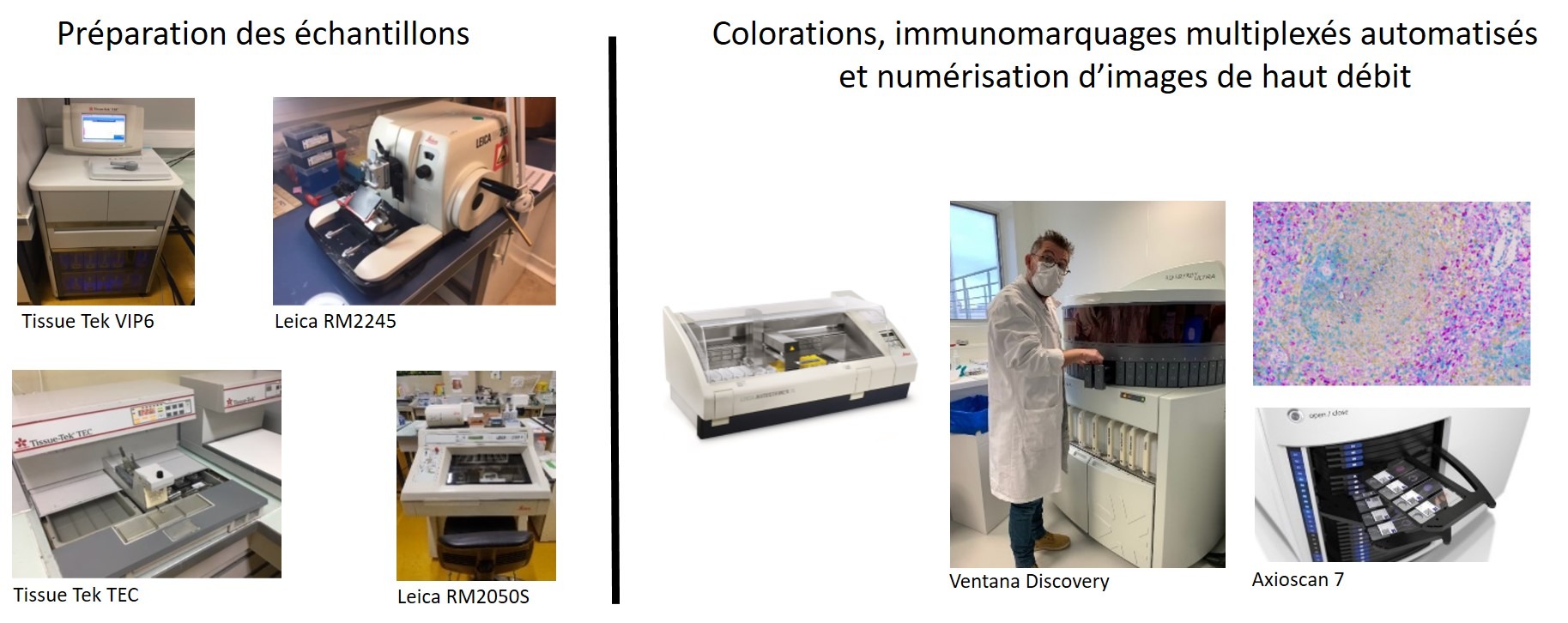 Immunohistochimie multiplexe